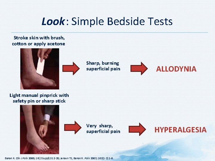 Look: Simple Bedside Tests Stroke skin with brush, cotton or apply acetone Sharp, burning