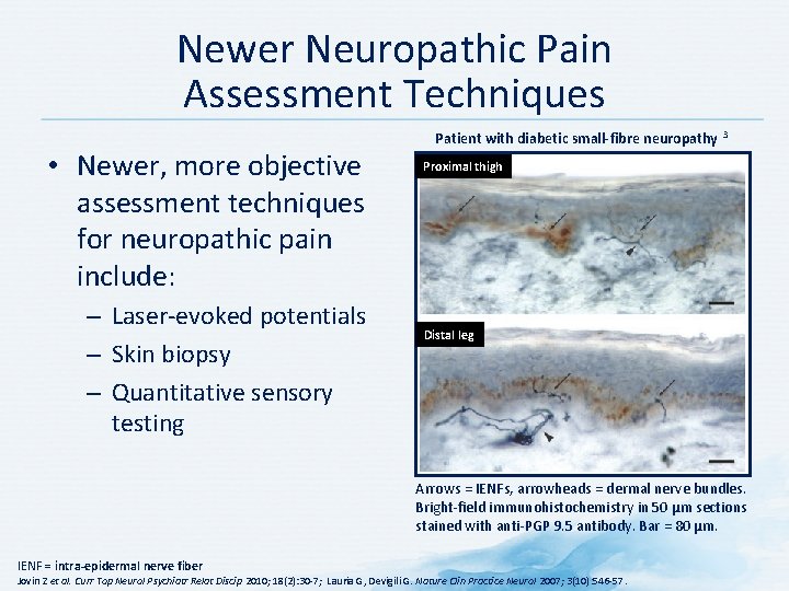 Newer Neuropathic Pain Assessment Techniques • Newer, more objective assessment techniques for neuropathic pain