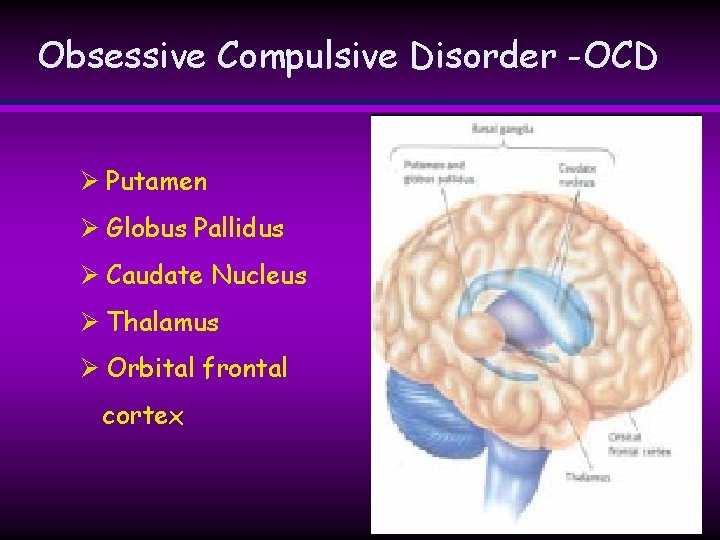 Obsessive Compulsive Disorder -OCD Ø Putamen Ø Globus Pallidus Ø Caudate Nucleus Ø Thalamus Obsessive Compulsive Disorder -OCD Ø Putamen Ø Globus Pallidus Ø Caudate Nucleus Ø Thalamus