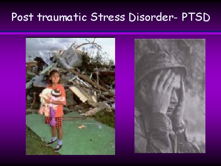 Post traumatic Stress Disorder- PTSD Post traumatic Stress Disorder- PTSD
