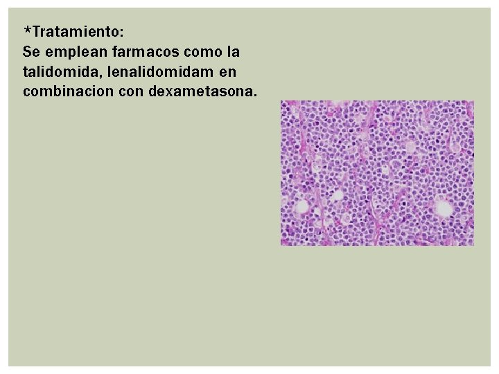 *Tratamiento: Se emplean farmacos como la talidomida, lenalidomidam en combinacion con dexametasona. *Tratamiento: Se emplean farmacos como la talidomida, lenalidomidam en combinacion con dexametasona.