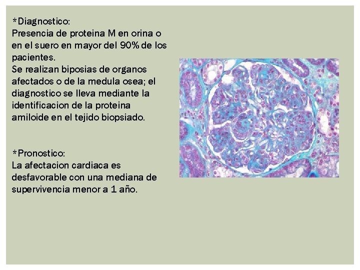 *Diagnostico: Presencia de proteina M en orina o en el suero en mayor del *Diagnostico: Presencia de proteina M en orina o en el suero en mayor del