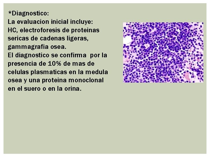 *Diagnostico: La evaluacion inicial incluye: HC, electroforesis de proteinas sericas de cadenas ligeras, gammagrafia *Diagnostico: La evaluacion inicial incluye: HC, electroforesis de proteinas sericas de cadenas ligeras, gammagrafia