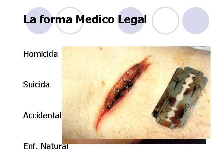 La forma Medico Legal Homicida Suicida Accidental Enf. Natural 