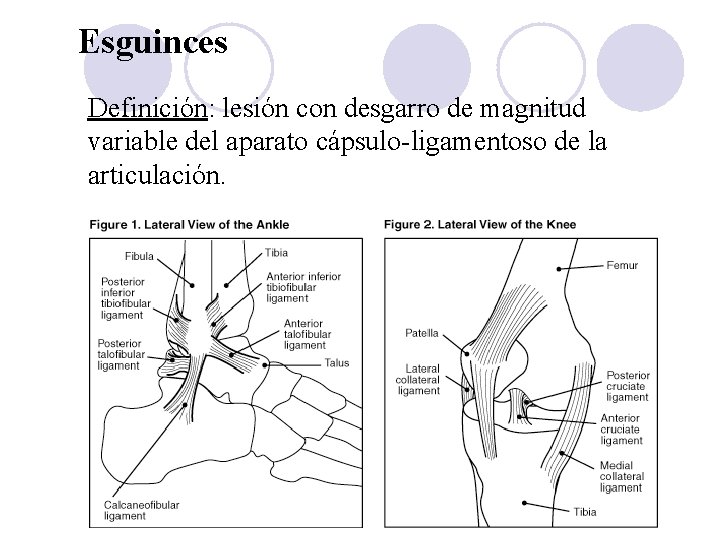 Esguinces Definición: lesión con desgarro de magnitud variable del aparato cápsulo-ligamentoso de la articulación.