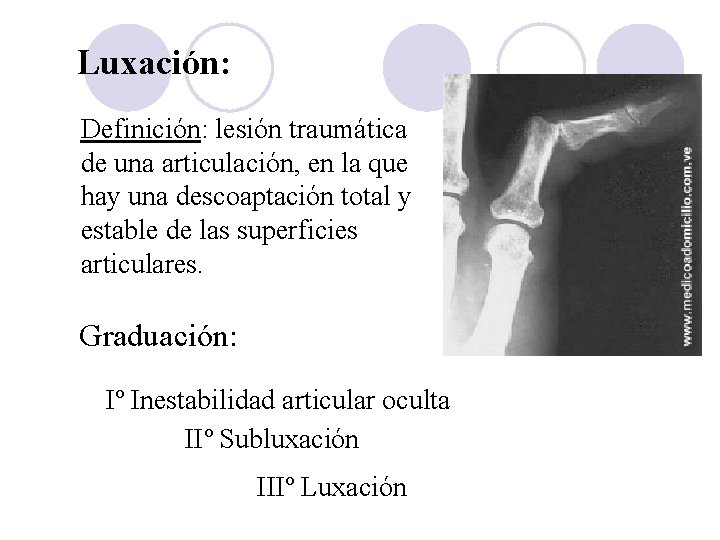 Luxación: Definición: lesión traumática de una articulación, en la que hay una descoaptación total