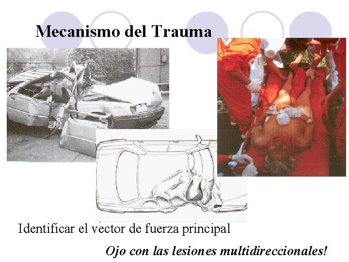 Mecanismo del Trauma Identificar el vector de fuerza principal Ojo con las lesiones multidireccionales!