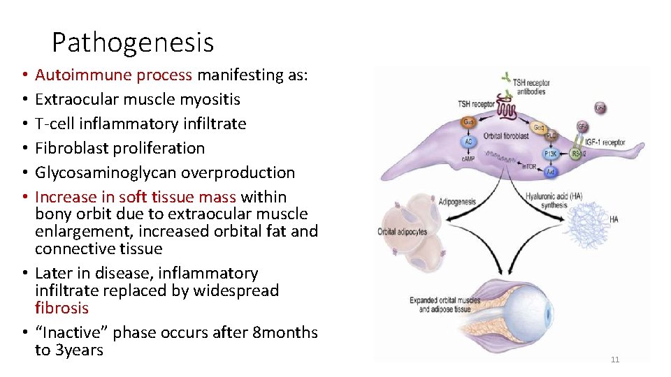 Pathogenesis Autoimmune process manifesting as: Extraocular muscle myositis T-cell inflammatory infiltrate Fibroblast proliferation Glycosaminoglycan