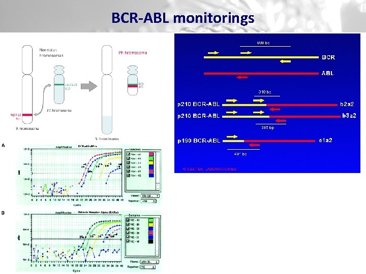 BCR-ABL monitorings 