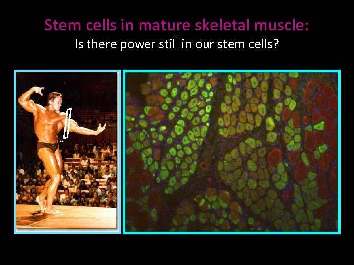 Stem cells in mature skeletal muscle: Is there power still in our stem cells?