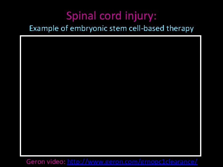 Spinal cord injury: Example of embryonic stem cell-based therapy Geron video: http: //www. geron.