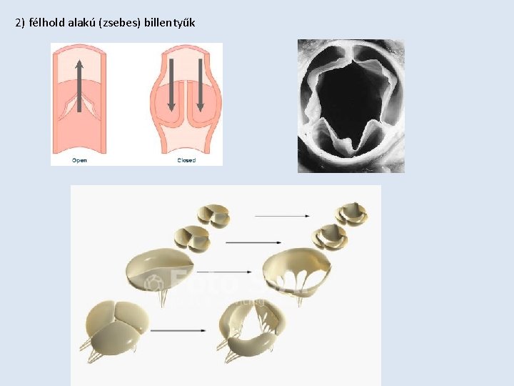 2) félhold alakú (zsebes) billentyűk 