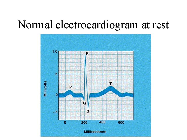 Normal electrocardiogram at rest 