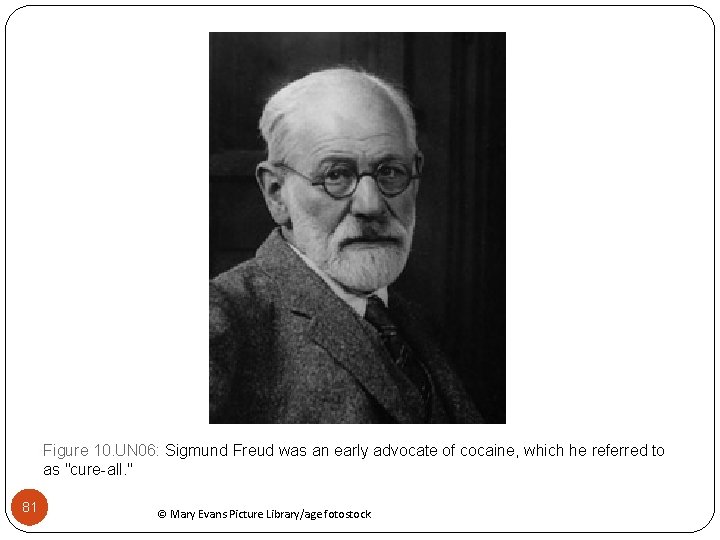 Figure 10. UN 06: Sigmund Freud was an early advocate of cocaine, which he