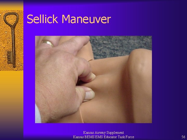 Sellick Maneuver Kansas Airway Supplement Kansas BEMS Educator Task Force 56 