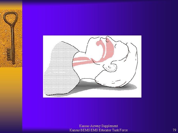 Kansas Airway Supplement Kansas BEMS Educator Task Force 79 