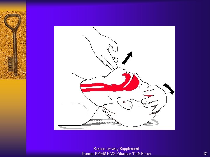 Kansas Airway Supplement Kansas BEMS Educator Task Force 81 