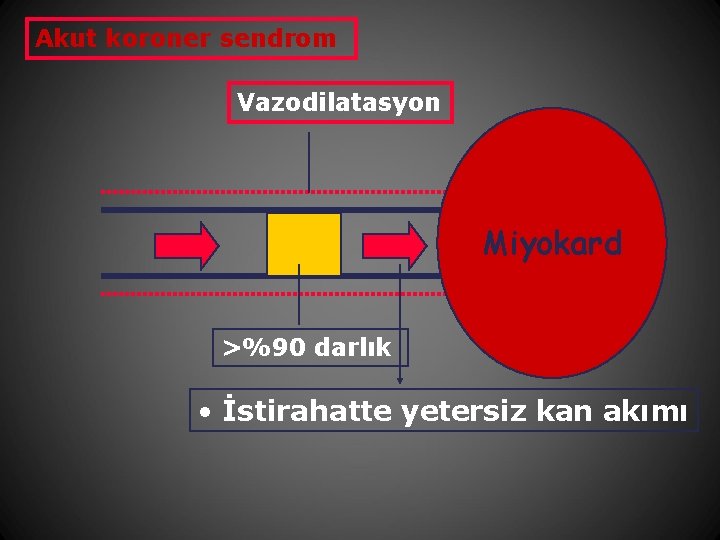 Akut koroner sendrom Vazodilatasyon Miyokard >%90 darlık • İstirahatte yetersiz kan akımı 