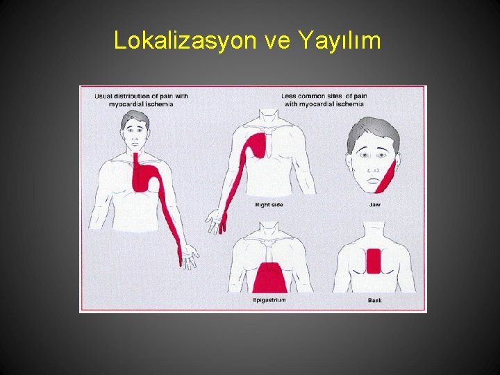 Lokalizasyon ve Yayılım 