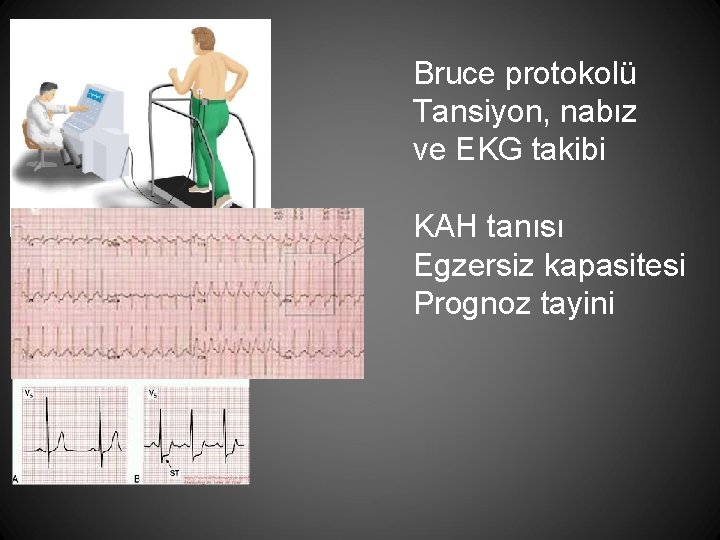 Bruce protokolü Tansiyon, nabız ve EKG takibi KAH tanısı Egzersiz kapasitesi Prognoz tayini 