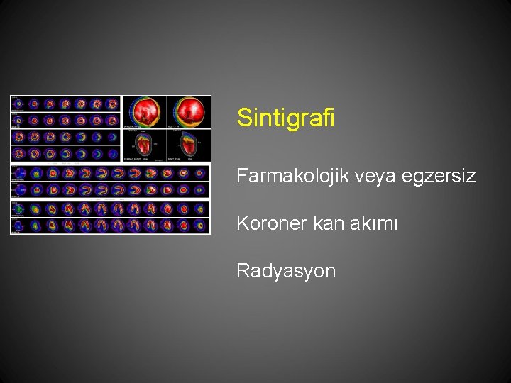 Sintigrafi Farmakolojik veya egzersiz Koroner kan akımı Radyasyon 