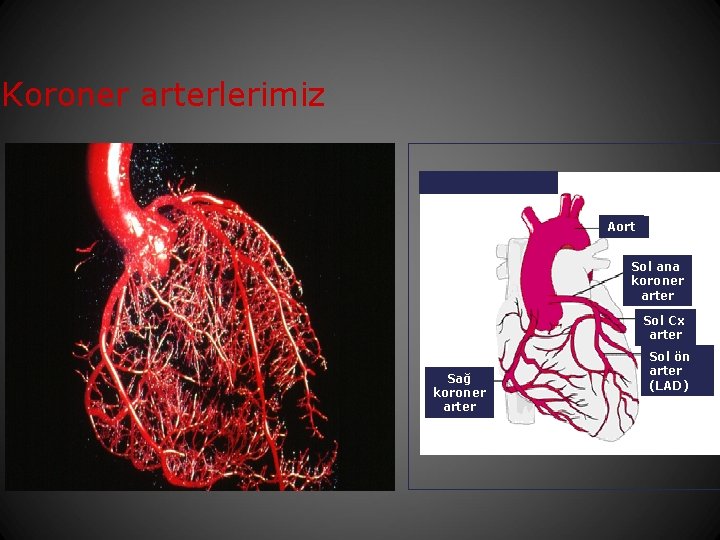 Koroner arterlerimiz Aort Sol ana koroner arter Sol Cx arter Sağ koroner arter Sol