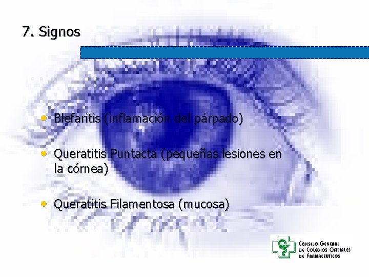 7. Signos • Blefaritis (inflamación del párpado) • Queratitis Puntacta (pequeñas lesiones en la 7. Signos • Blefaritis (inflamación del párpado) • Queratitis Puntacta (pequeñas lesiones en la
