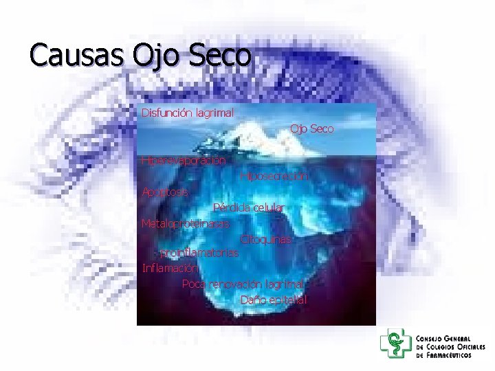 Causas Ojo Seco Disfunción lagrimal Ojo Seco Hiperevaporación Hiposecreción Apoptosis Pérdida celular Metaloproteinasas Citoquinas Causas Ojo Seco Disfunción lagrimal Ojo Seco Hiperevaporación Hiposecreción Apoptosis Pérdida celular Metaloproteinasas Citoquinas