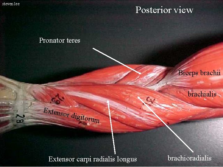 steven lee Posterior view Pronator teres Biceps brachii brachialis Extens or digi to rum