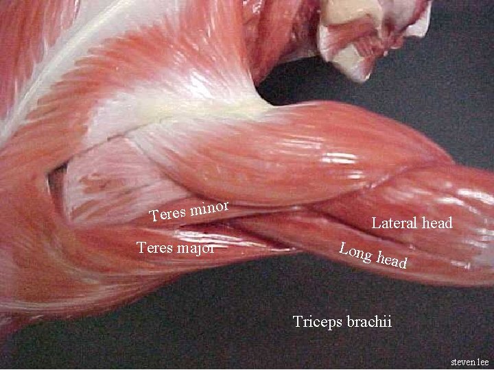 r ino Teres major Lateral head Long head Triceps brachii steven lee 