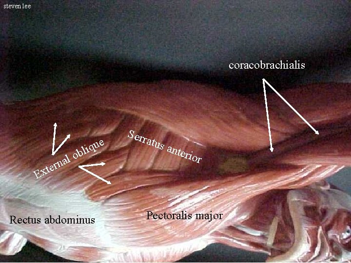 steven lee coracobrachialis e il qu b o l a rn e t x