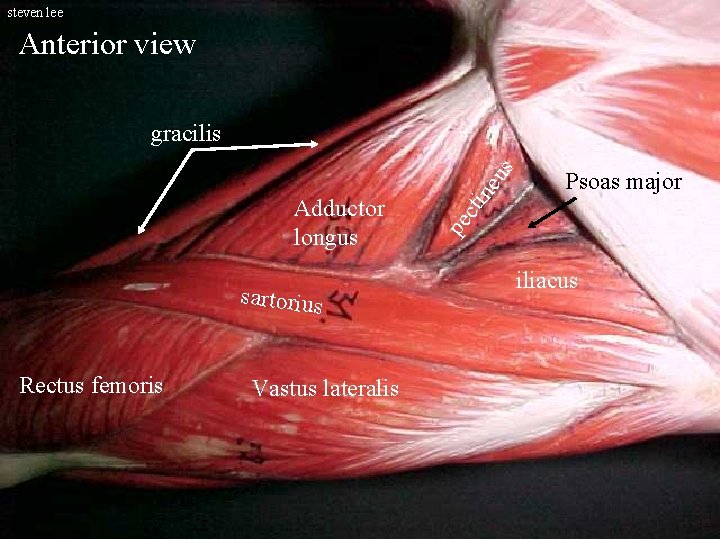 steven lee Anterior view sartorius Rectus femoris Vastus lateralis Psoas major pe Adductor longus