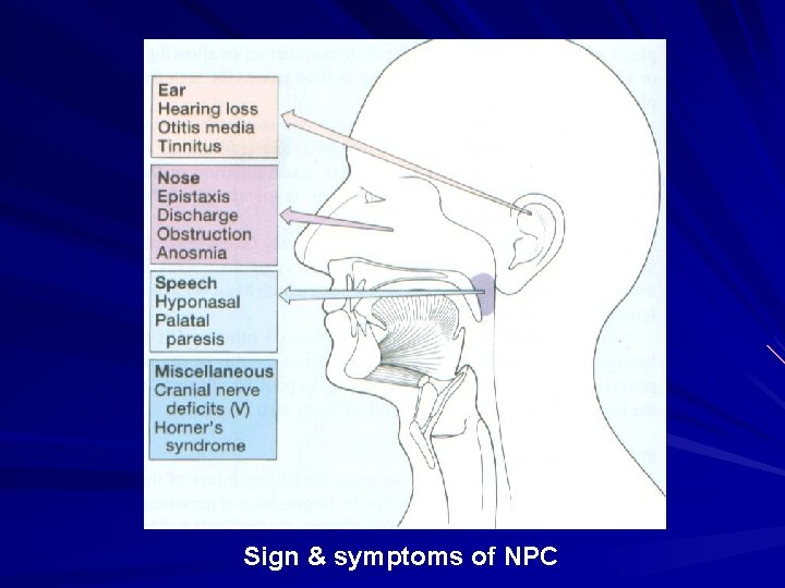 Sign & symptoms of NPC Sign & symptoms of NPC