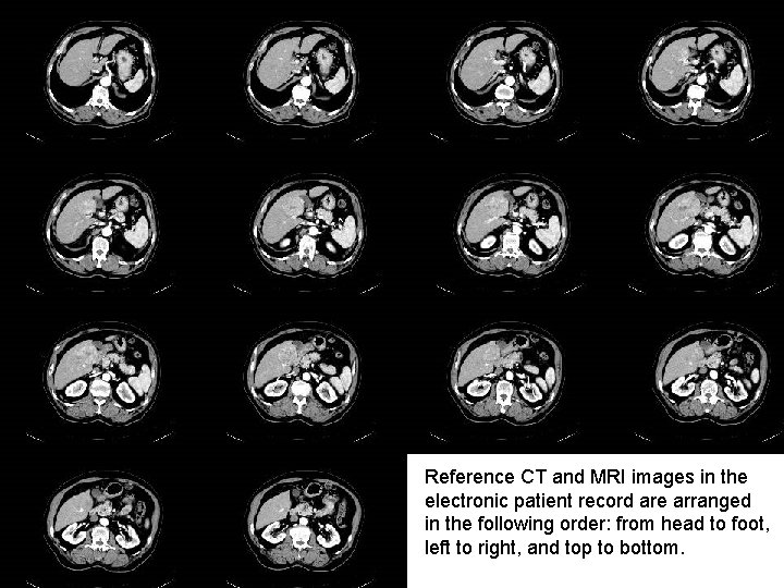 11 Reference CT and MRI images in the electronic patient record are arranged in 11 Reference CT and MRI images in the electronic patient record are arranged in