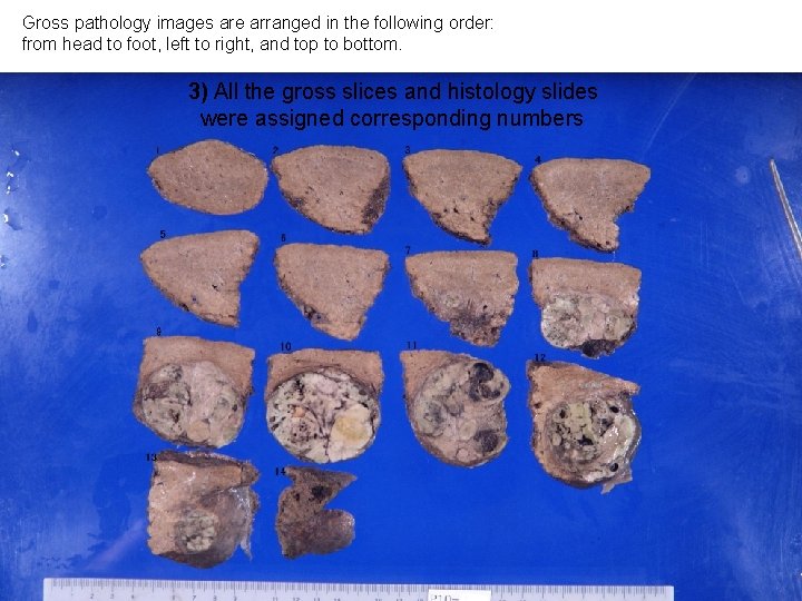 Gross pathology images are arranged in the following order: from head to foot, left Gross pathology images are arranged in the following order: from head to foot, left