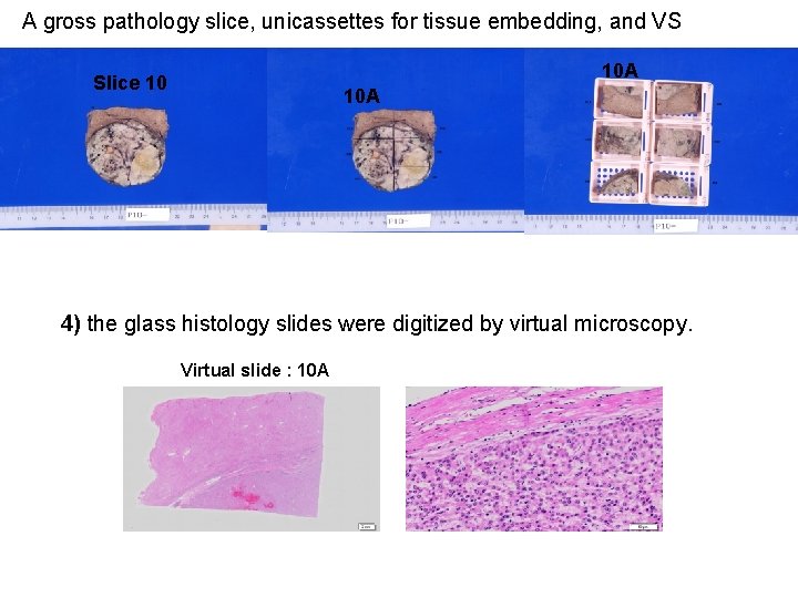 A gross pathology slice, unicassettes for tissue embedding, and VS 10 A Slice 10 A gross pathology slice, unicassettes for tissue embedding, and VS 10 A Slice 10