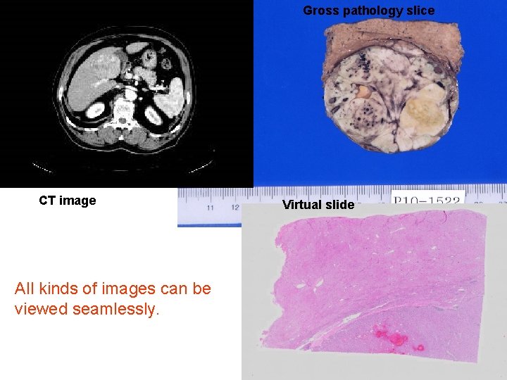 Gross pathology slice CT image All kinds of images can be viewed seamlessly. Virtual Gross pathology slice CT image All kinds of images can be viewed seamlessly. Virtual