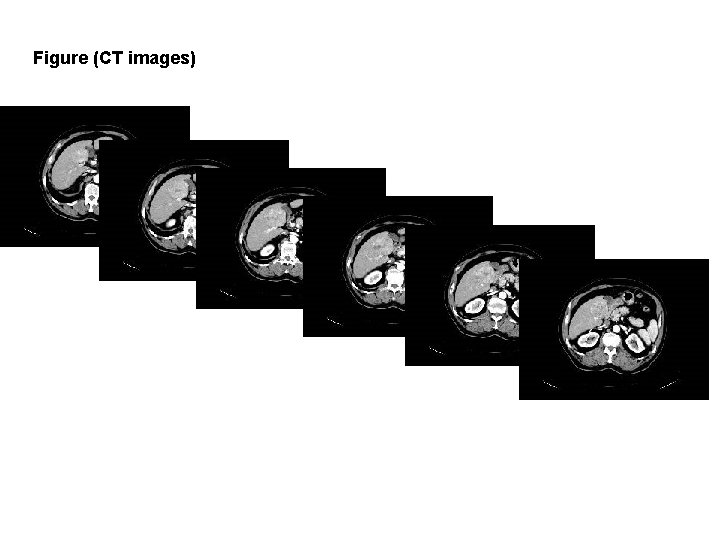 Figure (CT images) Figure (CT images)