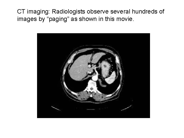 CT imaging: Radiologists observe several hundreds of images by “paging” as shown in this CT imaging: Radiologists observe several hundreds of images by “paging” as shown in this