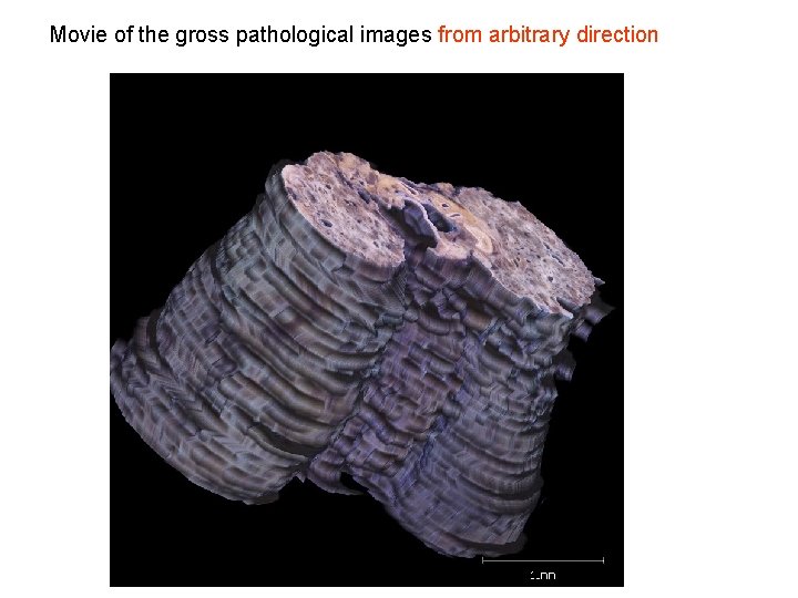Movie of the gross pathological images from arbitrary direction Movie of the gross pathological images from arbitrary direction