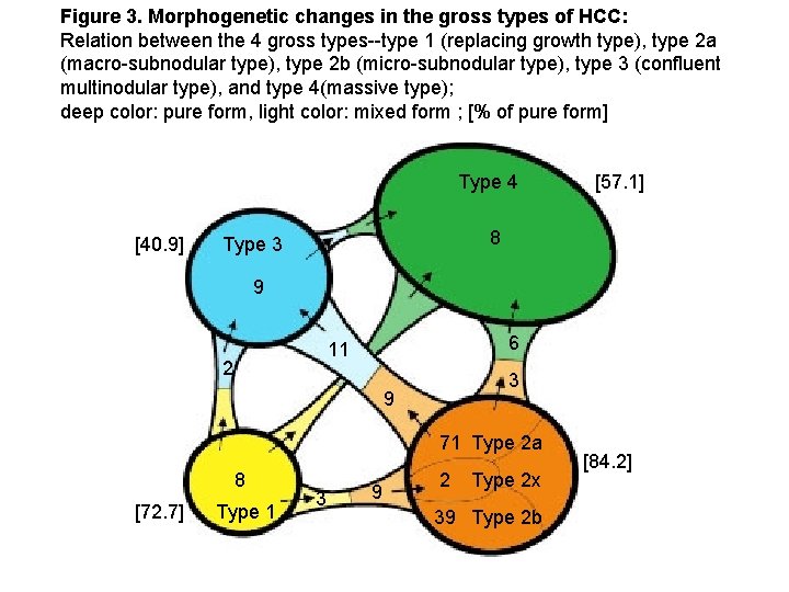 Figure 3. Morphogenetic changes in the gross types of HCC: Relation between the 4 Figure 3. Morphogenetic changes in the gross types of HCC: Relation between the 4
