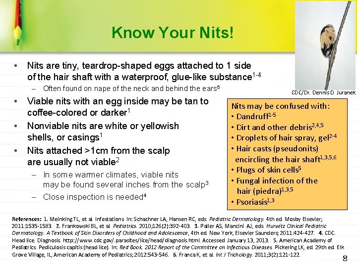 Know Your Nits! • Nits are tiny, teardrop-shaped eggs attached to 1 side of
