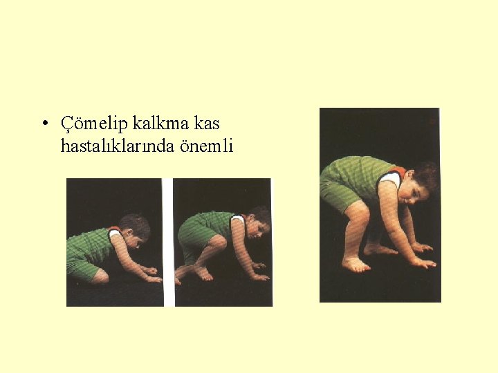• Çömelip kalkma kas hastalıklarında önemli • Çömelip kalkma kas hastalıklarında önemli