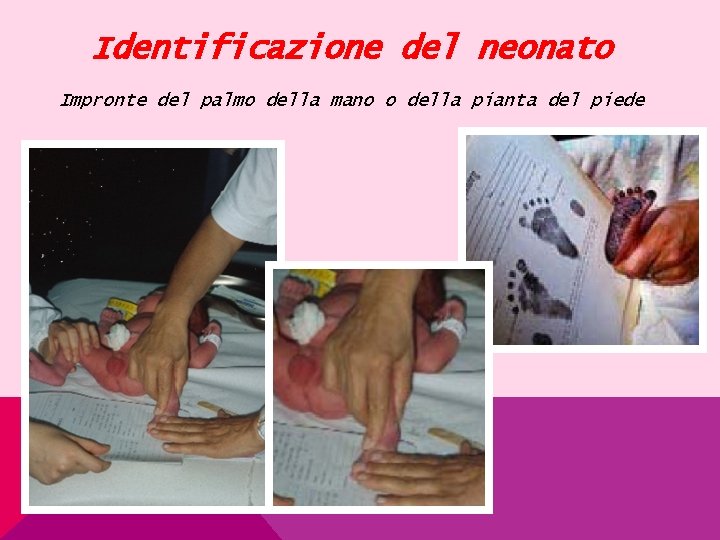 Identificazione del neonato Impronte del palmo della mano o della pianta del piede 