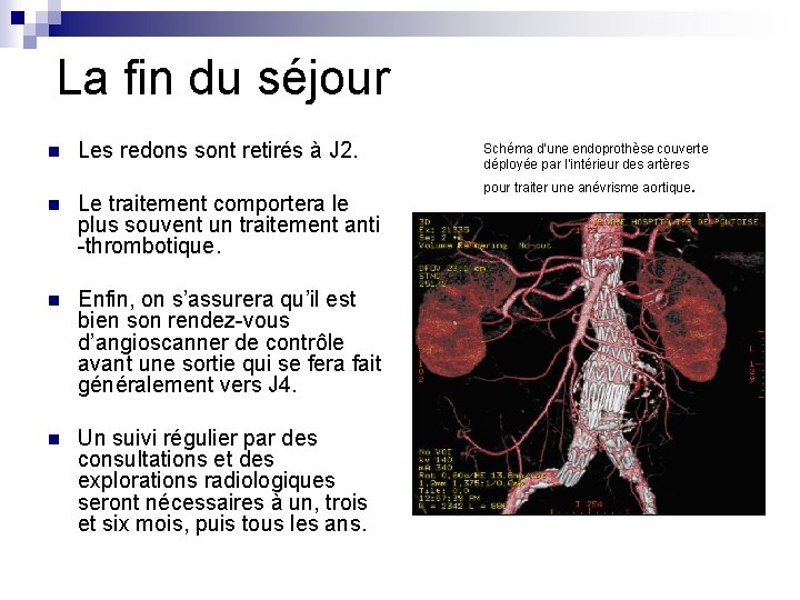 La fin du séjour n Les redons sont retirés à J 2. n Le