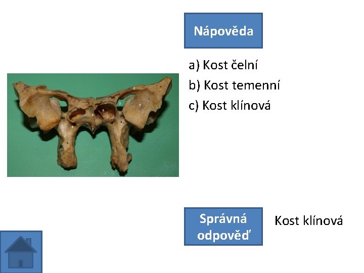 Nápověda a) Kost čelní b) Kost temenní c) Kost klínová Správná odpověď Kost klínová