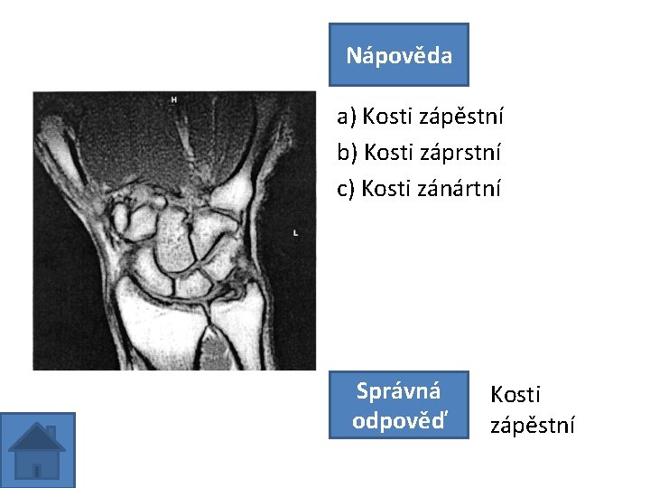 Nápověda a) Kosti zápěstní b) Kosti záprstní c) Kosti zánártní Správná odpověď Kosti zápěstní