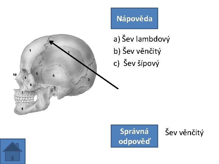 Nápověda a) Šev lambdový b) Šev věnčitý c) Šev šípový Správná odpověď Šev věnčitý