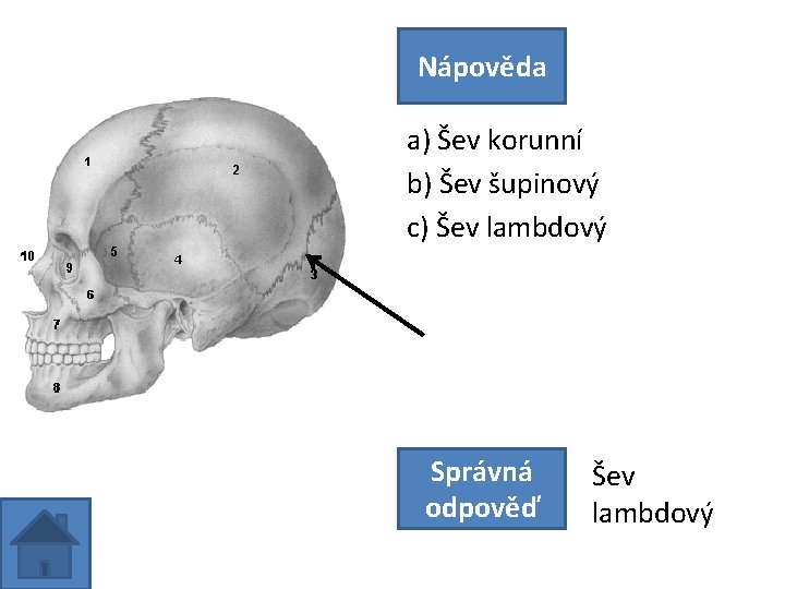 Nápověda a) Šev korunní b) Šev šupinový c) Šev lambdový Správná odpověď Šev lambdový