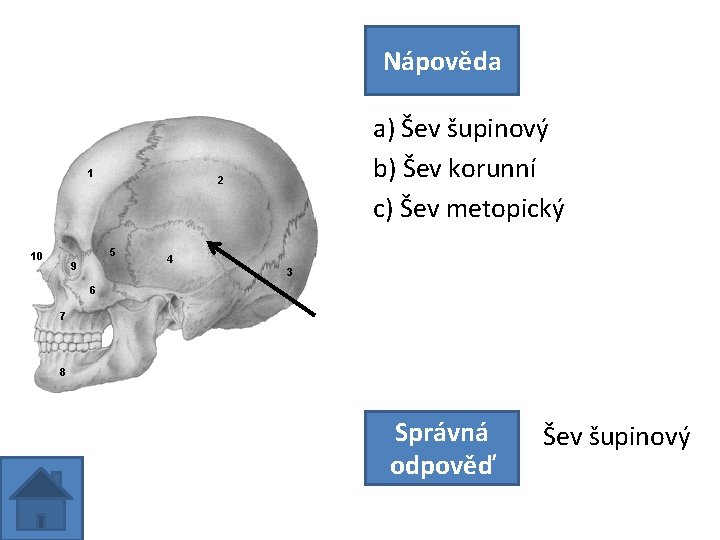 Nápověda a) Šev šupinový b) Šev korunní c) Šev metopický Správná odpověď Šev šupinový